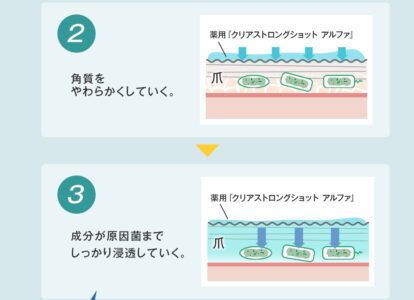 クリアストロングショットアルファ 効果ロジック 2